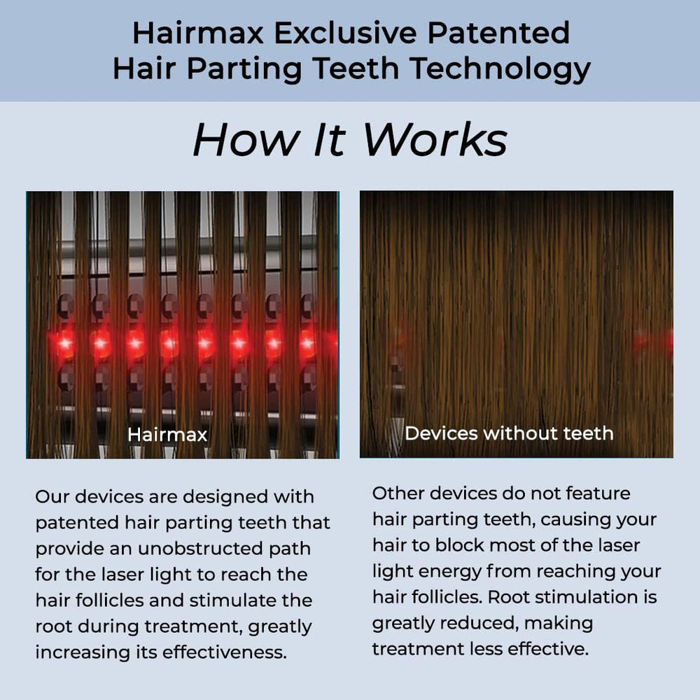 HairMax Ultima12 device delivering fuller-looking hair density with consistent use.