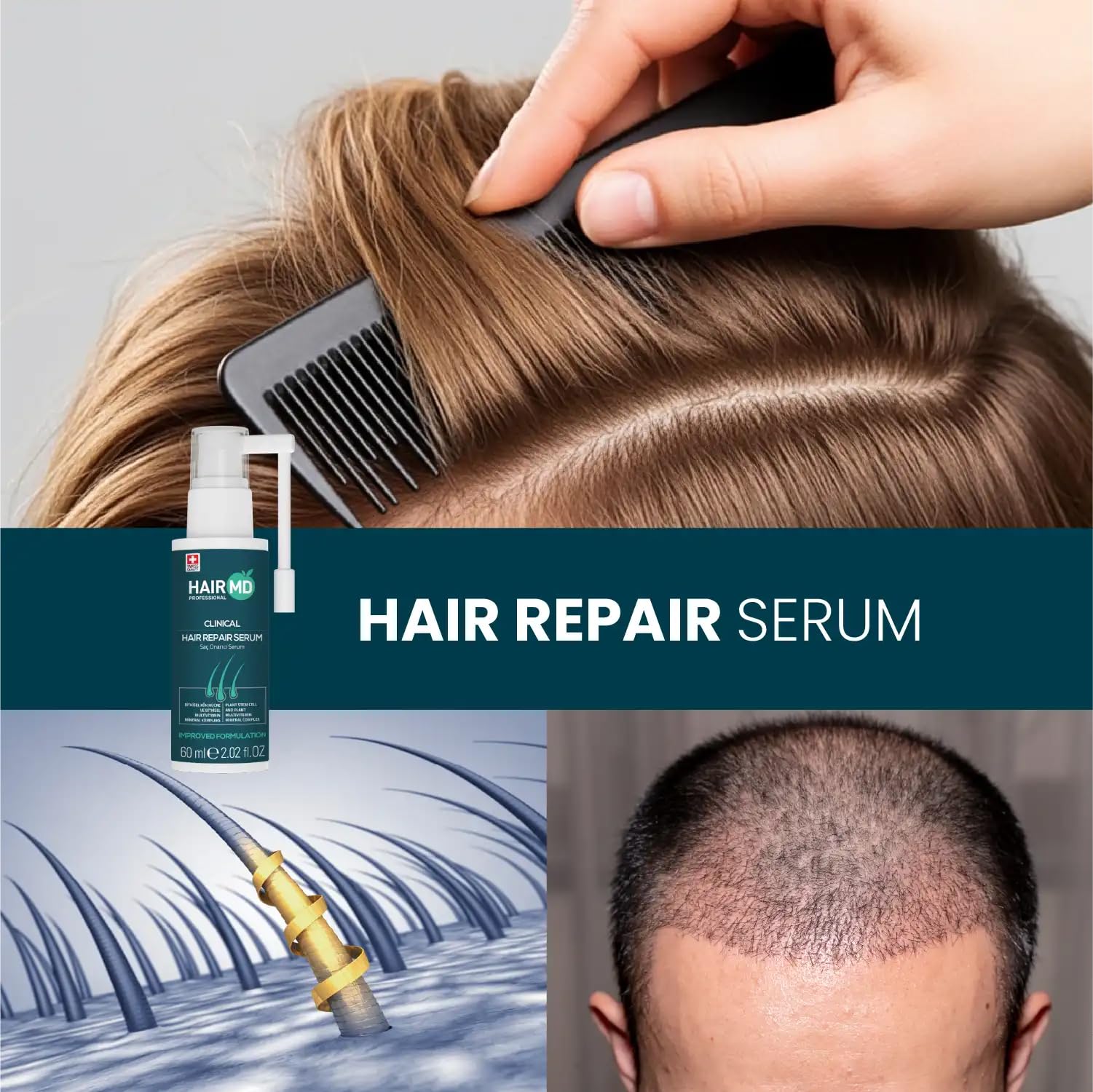 HairMD Transplant Clinical Repair Serum on surface shows ready-to-use design.