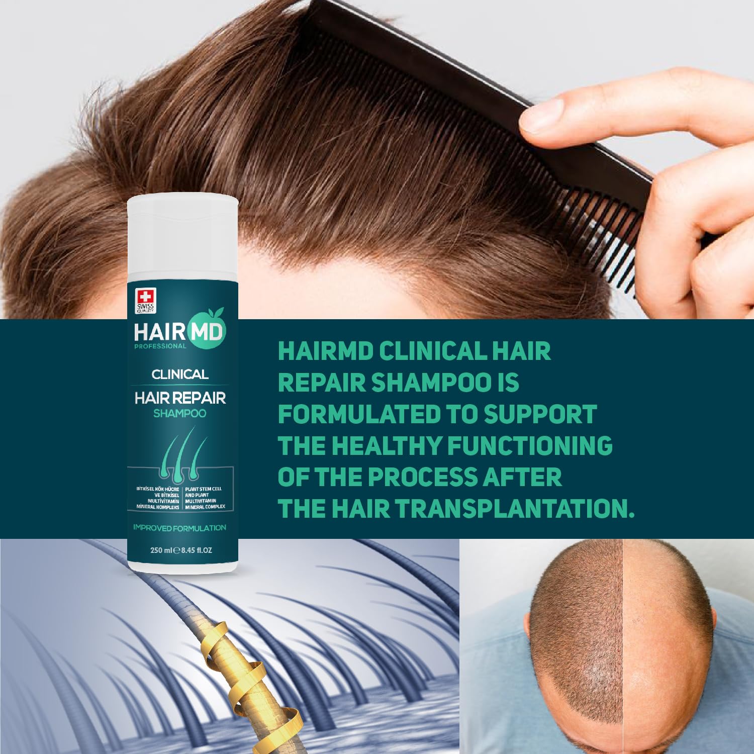 HairMD Transplant Clinical Repair Shampoo in hand for easy daily use.