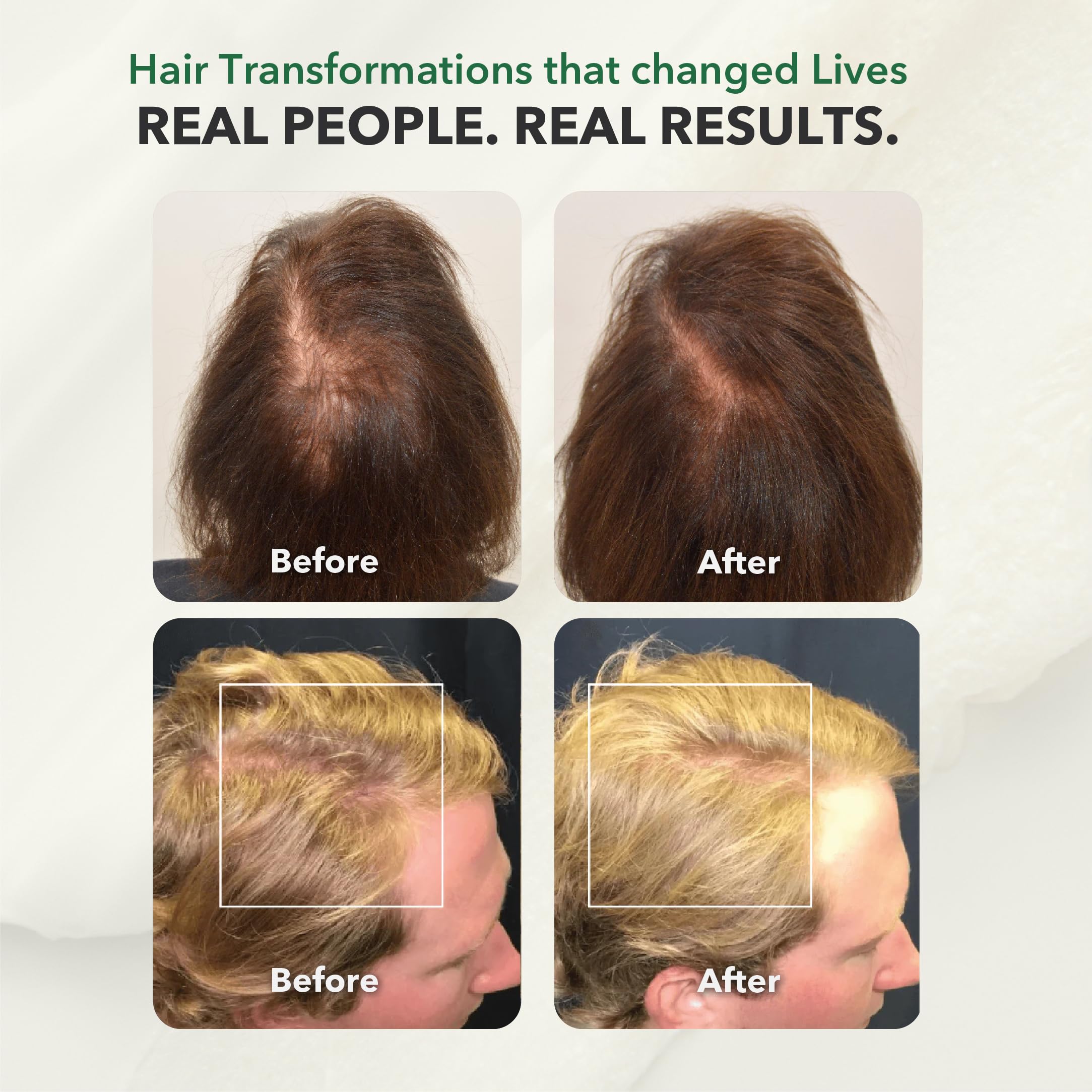 HairSmart wheat germ and jojoba oil provide nourishing volume.