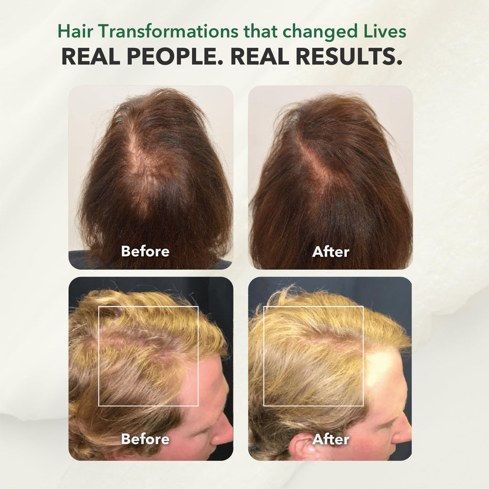 HairSmart wheat germ and jojoba oil provide nourishing volume.