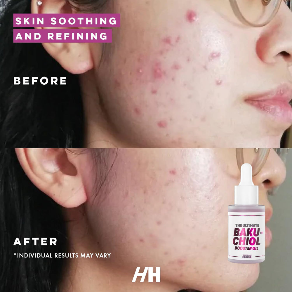 Handmade Heroes Bakuchiol oil application on neck demonstrates silky texture and gentle absorption.