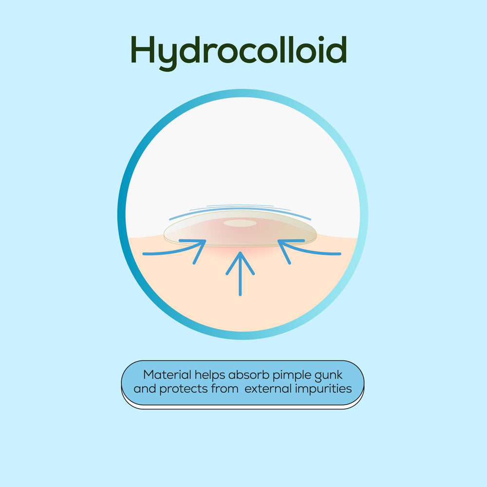Hanhoo Bundle collection supports targeted care for multiple breakouts