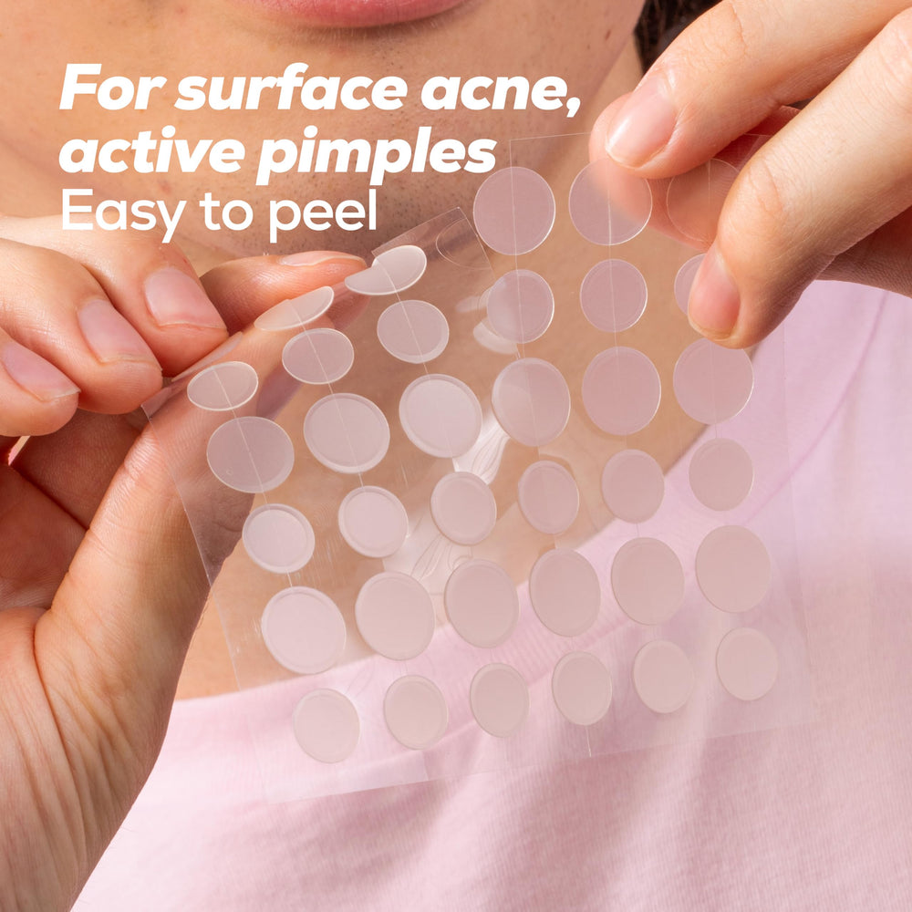 HANHOO hydrocolloid patches close-up show oil and pus absorption