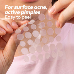 HANHOO hydrocolloid patches close-up show oil and pus absorption