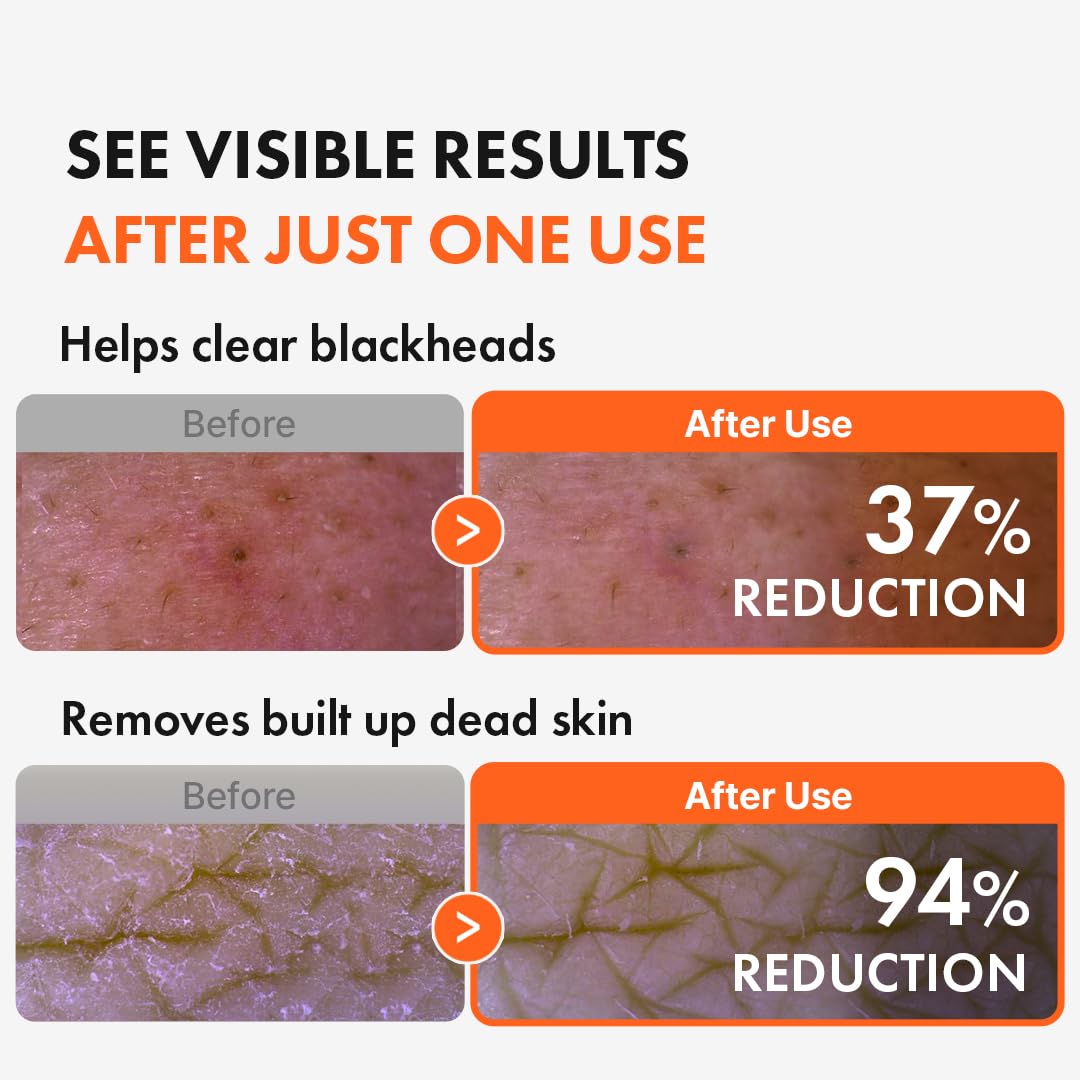Deep pore cleansing with Hanskin AHA Pore Cleansing Oil and plant oils.