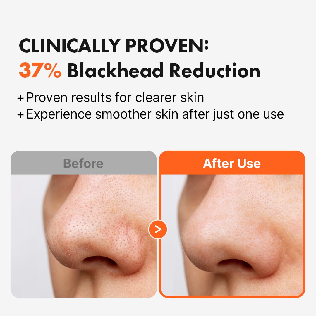 Hanskin AHA Pore Cleansing Oil removes waterproof makeup without eye irritation.