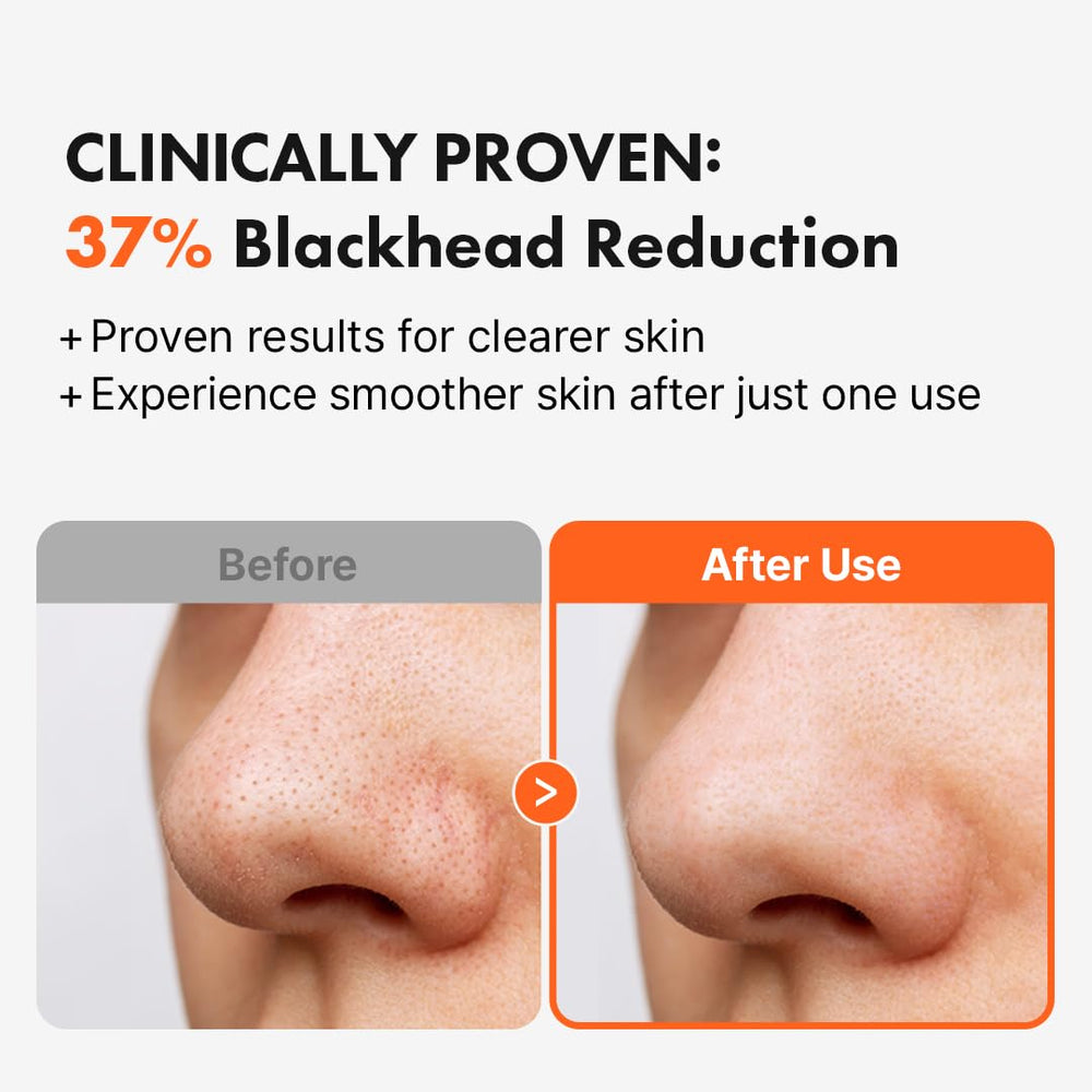 Hanskin AHA Pore Cleansing Oil removes waterproof makeup without eye irritation.