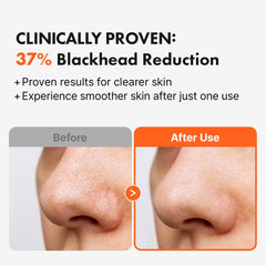 Hanskin AHA Pore Cleansing Oil removes waterproof makeup without eye irritation.