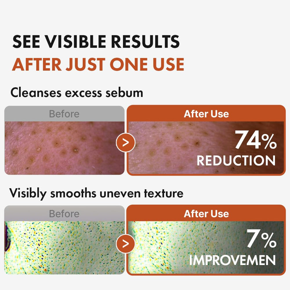 Hanskin BHA Pore Cleansing Oil on skin yields refreshed, balanced feel