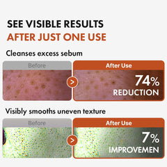 Hanskin BHA Pore Cleansing Oil on skin yields refreshed, balanced feel