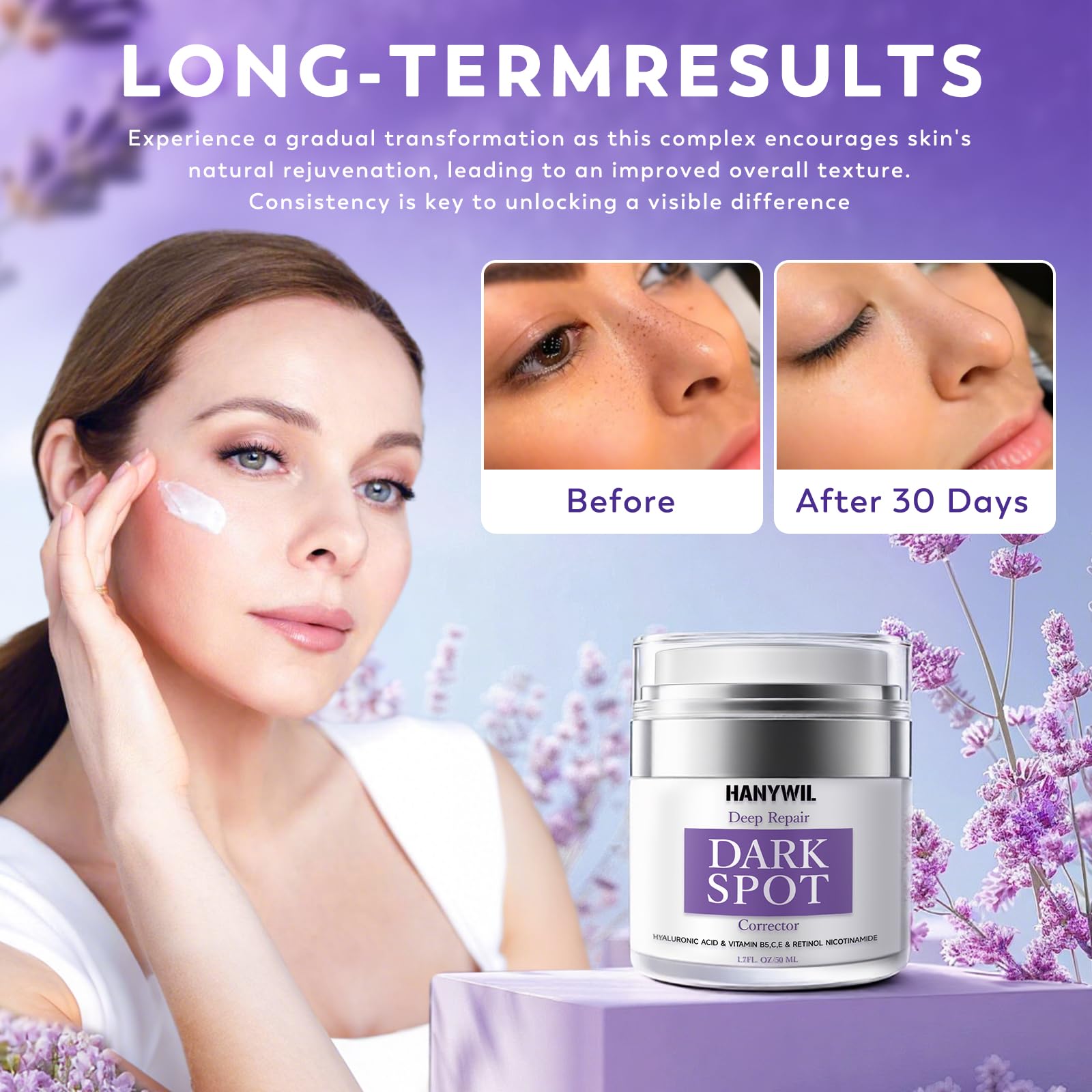 HANYWIL Dark Spot Remover application on hands for face and body