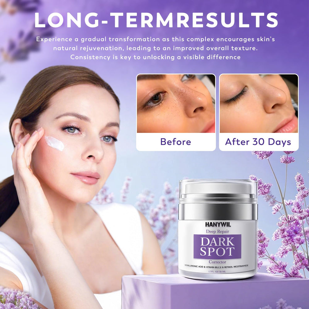 HANYWIL Dark Spot Remover application on hands for face and body