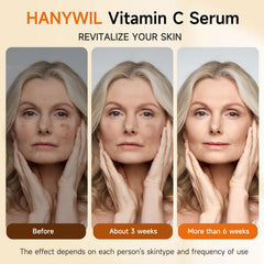 HANYWIL Hyaluronic acid hydration image emphasizing lasting moisture.