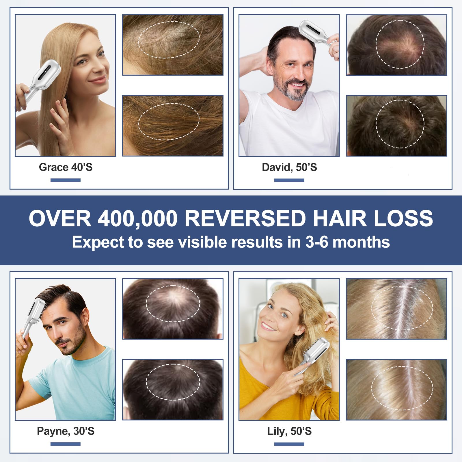 HAUBAT Laser Therapy Hair Growth Comb in use on scalp for light therapy.