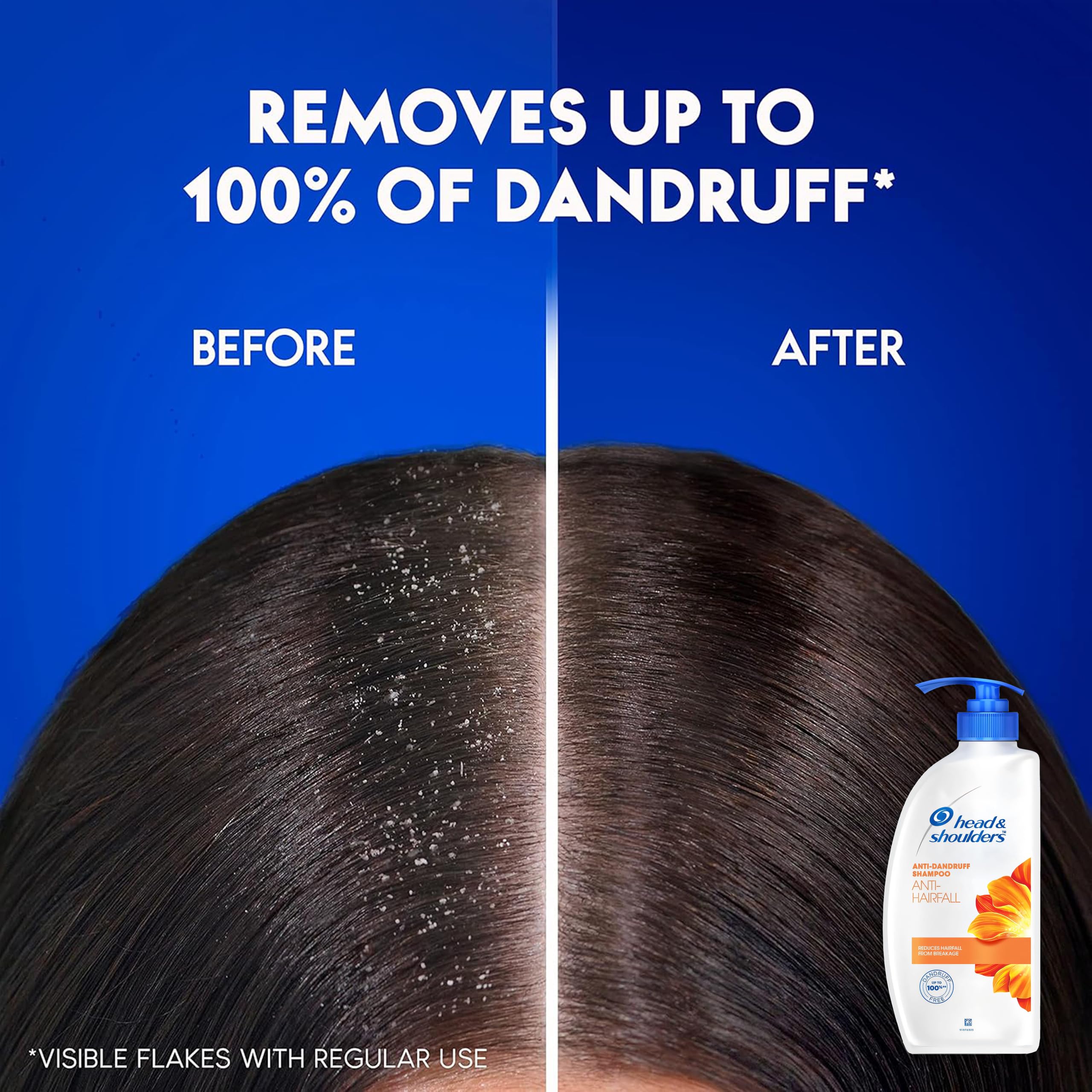 Two-pack packaging of Head & Shoulders anti-dandruff shampoo highlighted for value