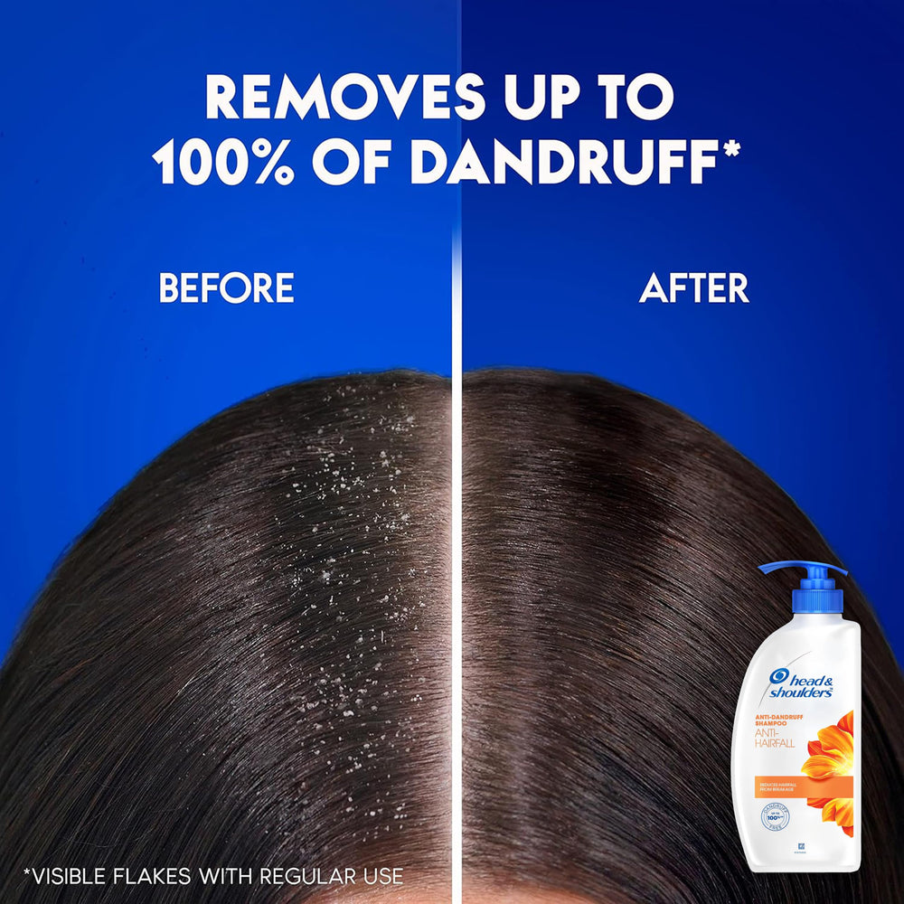 Two-pack packaging of Head & Shoulders anti-dandruff shampoo highlighted for value