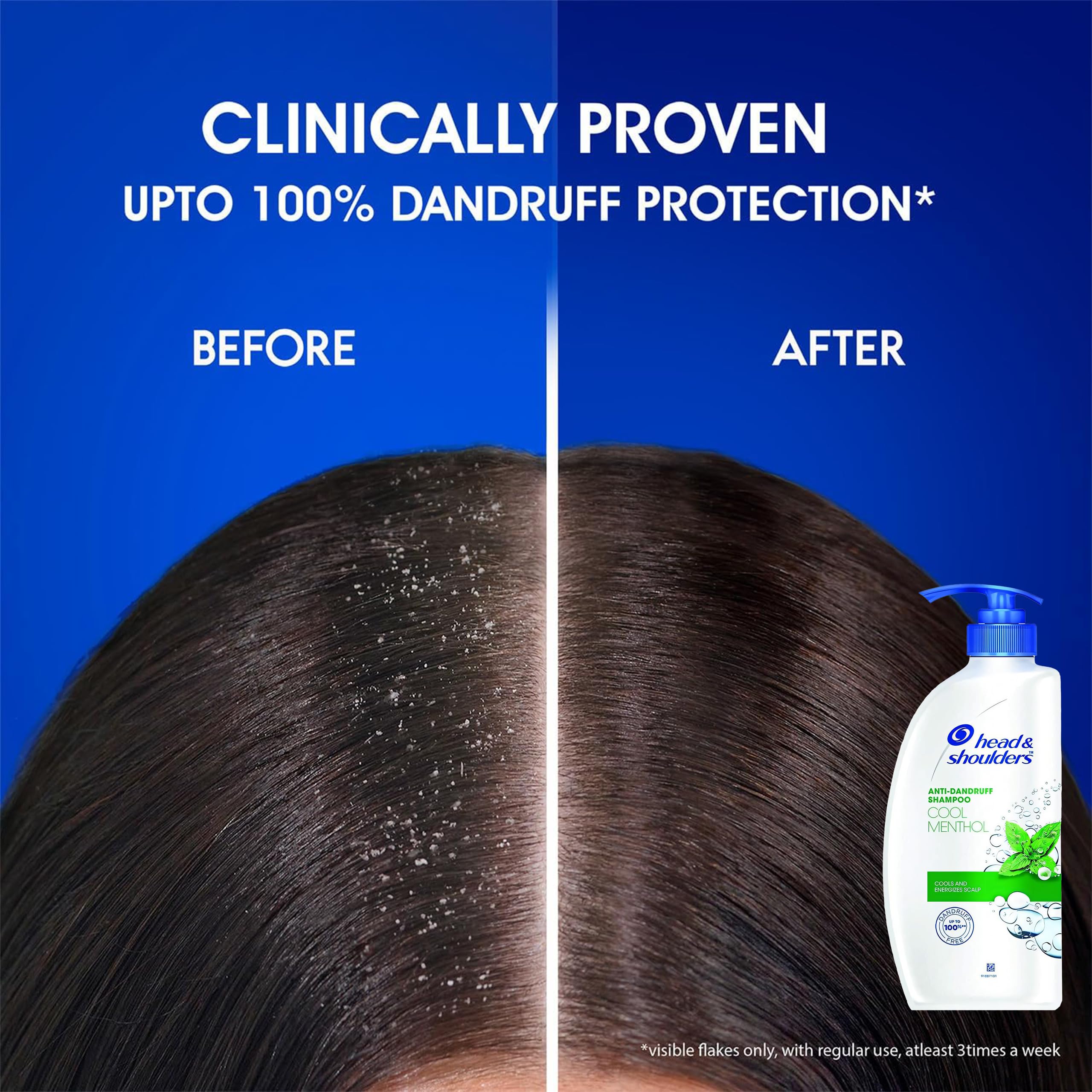 Head & Shoulders Cool Menthol shampoo daily cleansing for scalp comfort.