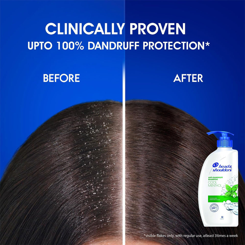 Head & Shoulders Cool Menthol shampoo daily cleansing for scalp comfort.
