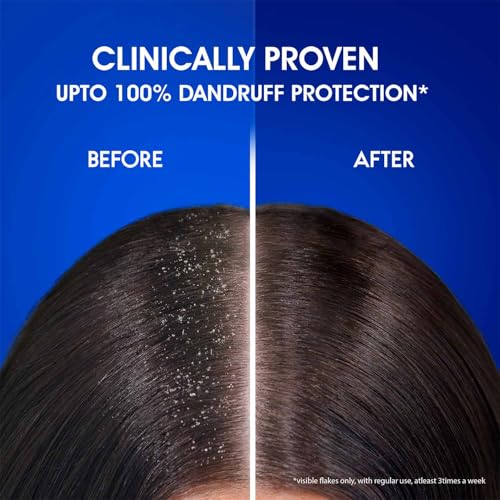 Head & Shoulders cool menthol shampoo tingling effect closeup.