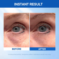 Close-up of HealthyDerm tube highlighting product and smooth application.