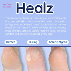 Healz patches close-up showing sterile gel layer for skin protection