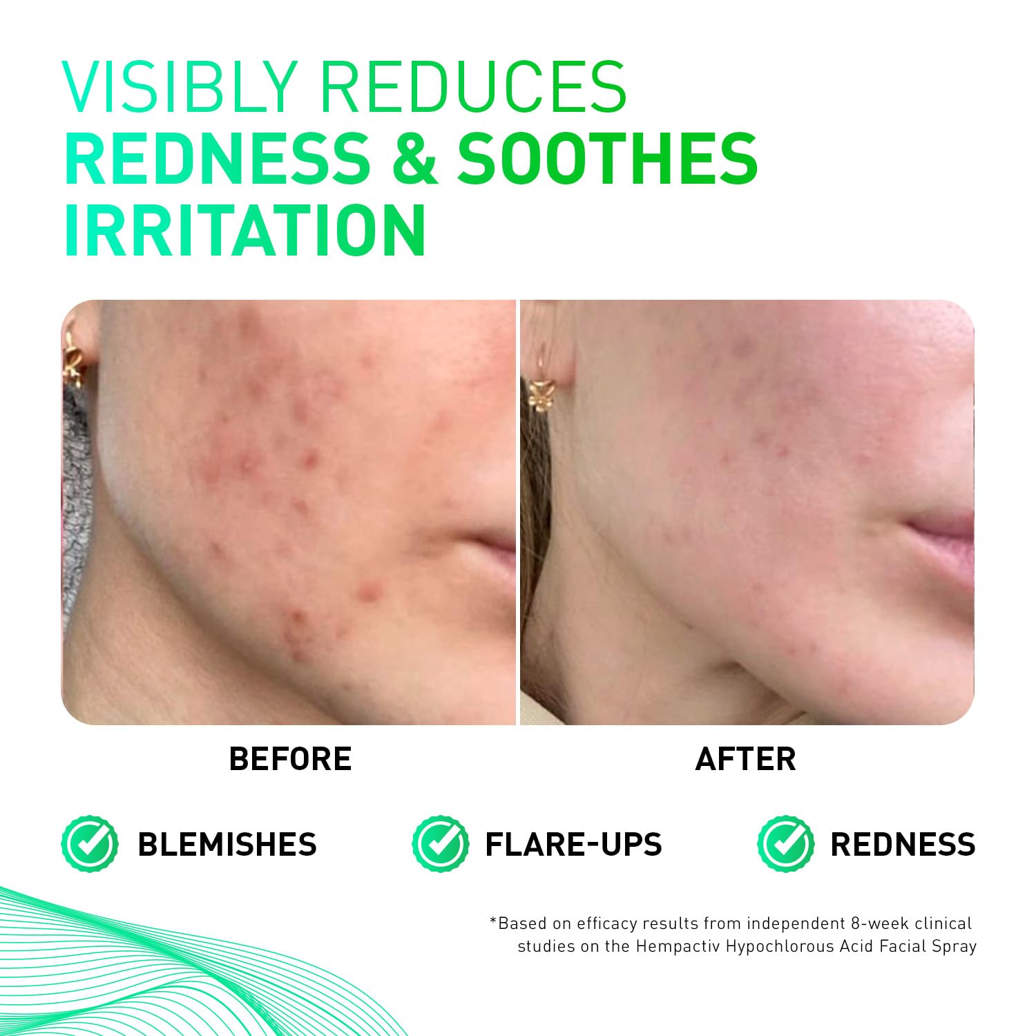 Close-up of HOCl mist on skin showing calming hydration from HEMPACTIV