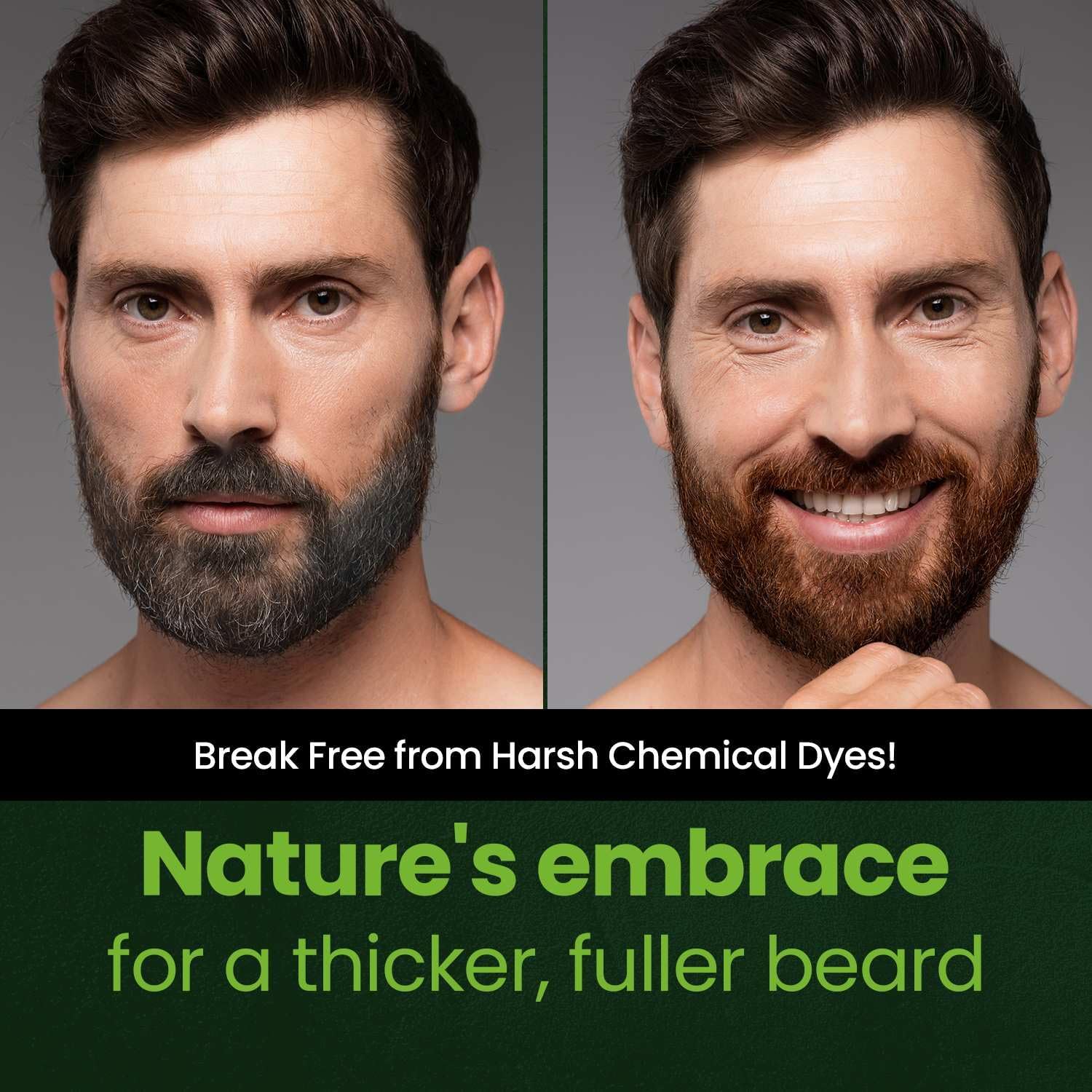 Herb Speedy skin-friendly dye reduces irritation while delivering natural-looking shade.