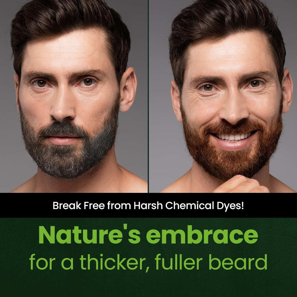 Herb Speedy skin-friendly dye reduces irritation while delivering natural-looking shade.