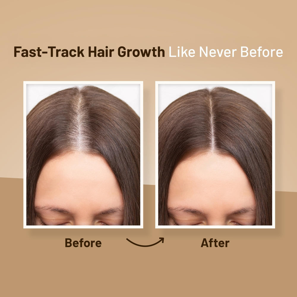Herbishh Regrowth Kit packaging conveys a complete 4in1 routine
