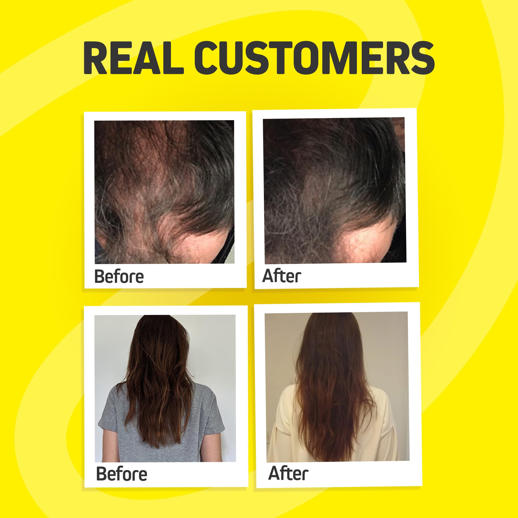 Herbtonics Beta Sitosterol blend ingredients on label imply balanced hair care.
