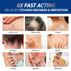 Closeup of Hermon Folliculitis Cream 2Pack texture for smooth application.