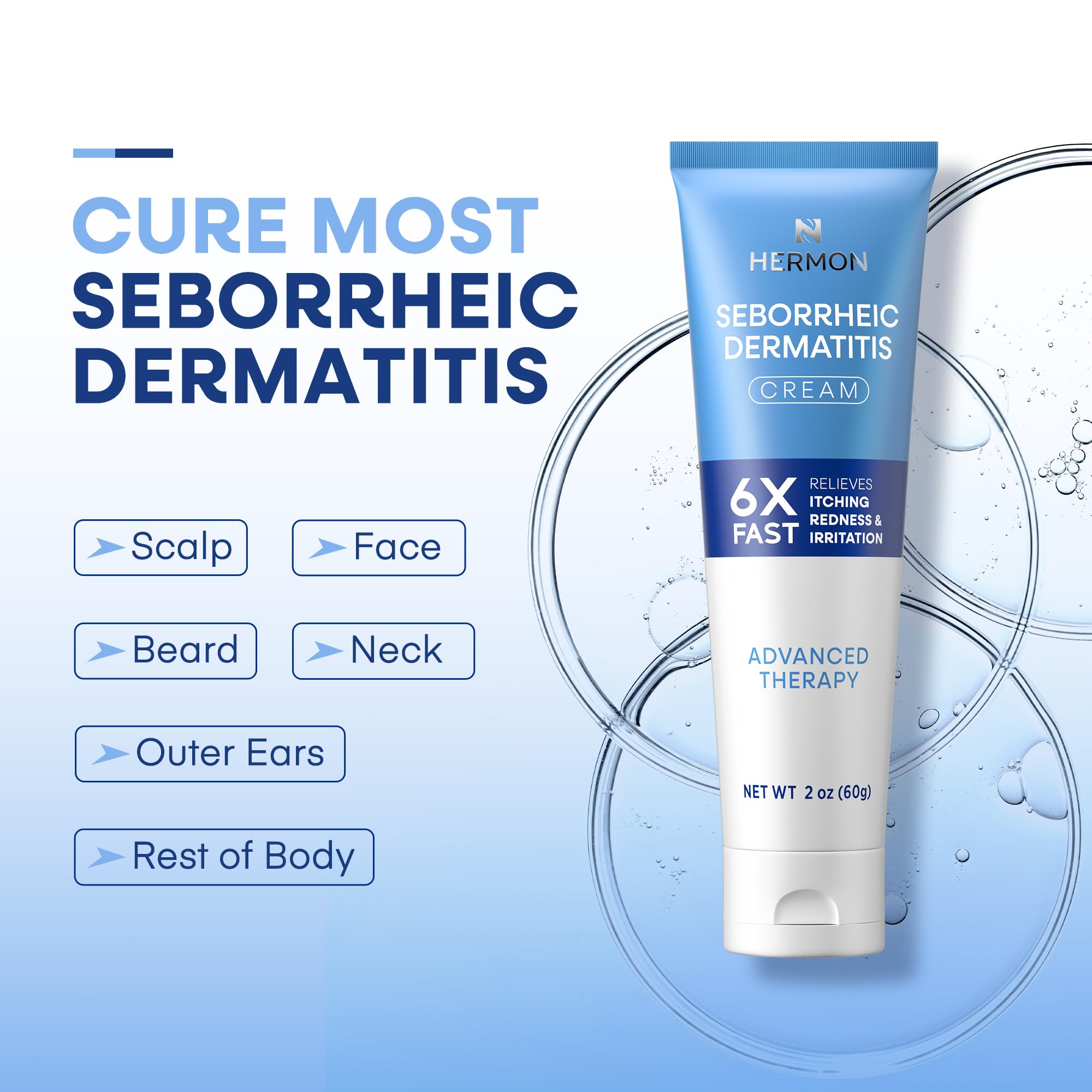 Hermon scalp care cream applied to scalp for soothing sensation.