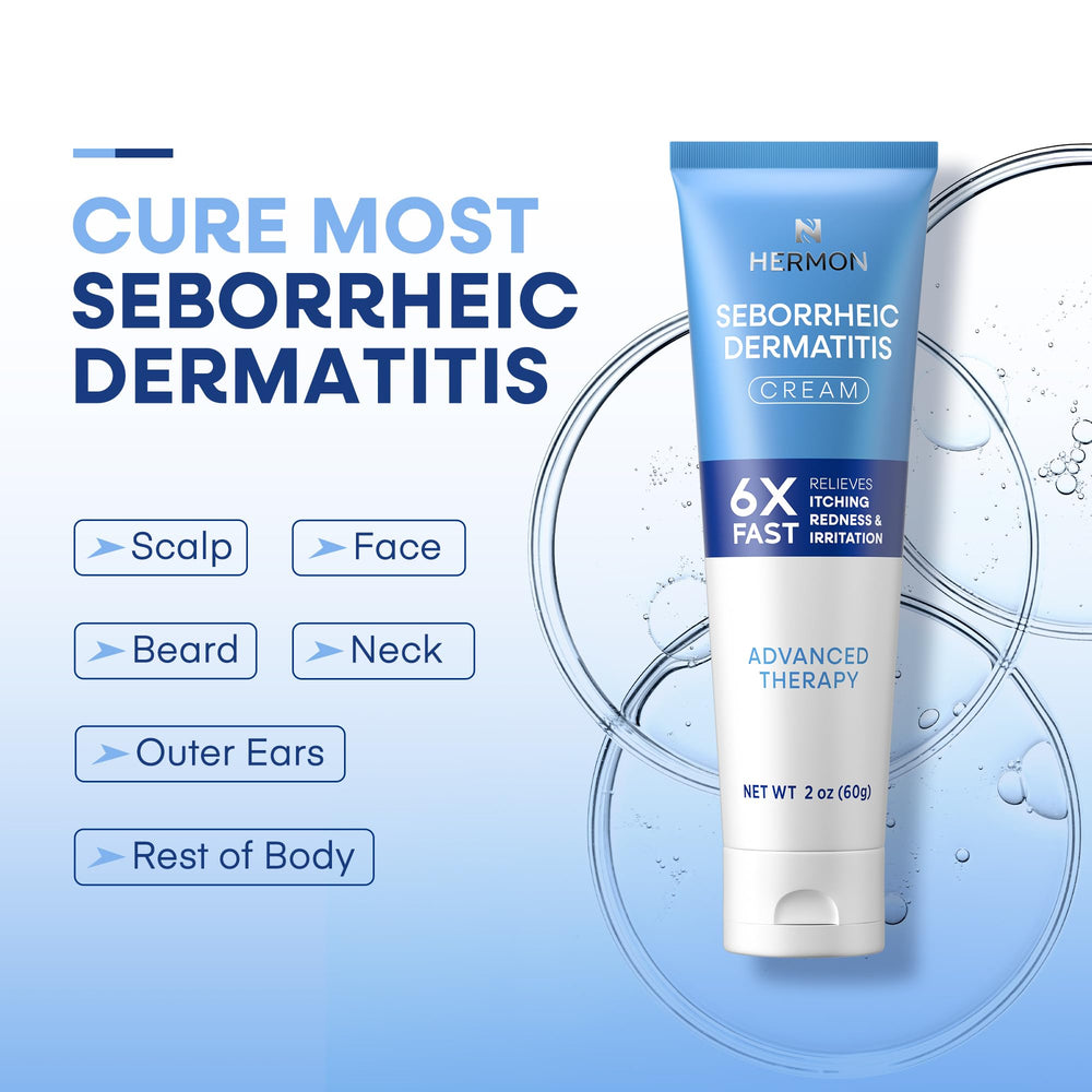 Hermon scalp care cream applied to scalp for soothing sensation.