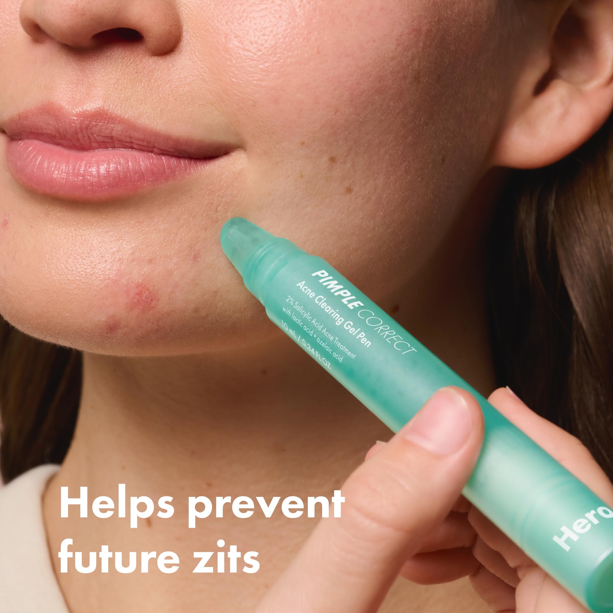 Precise tip from Hero Cosmetics Pimple Correct Pen for targeted application.