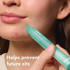 Precise tip from Hero Cosmetics Pimple Correct Pen for targeted application.