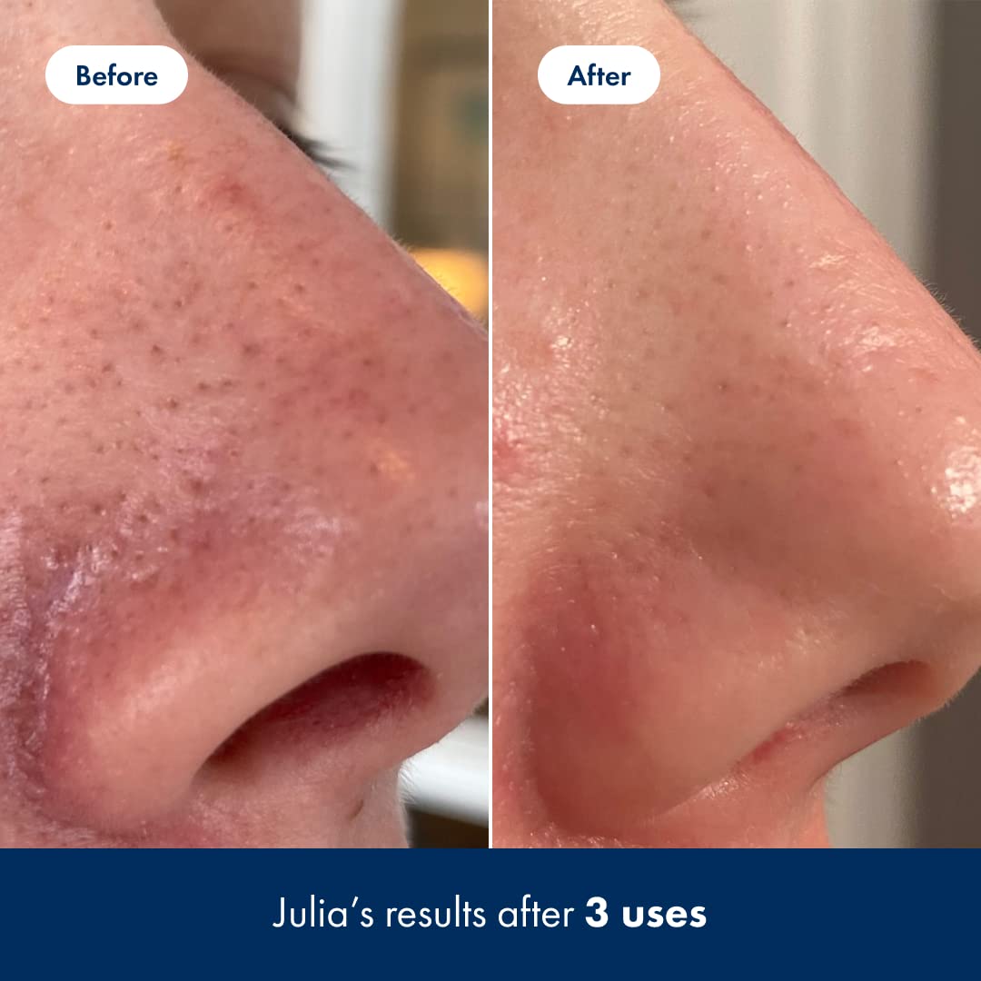 Hero Cosmetics Pore Release aloe-lotus formula close-up visual