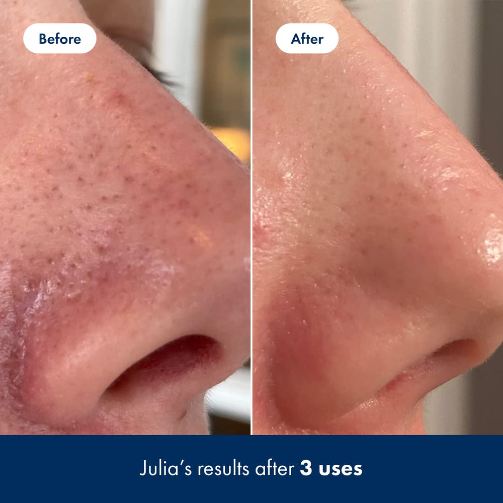 Hero Cosmetics Pore Release aloe-lotus formula close-up visual