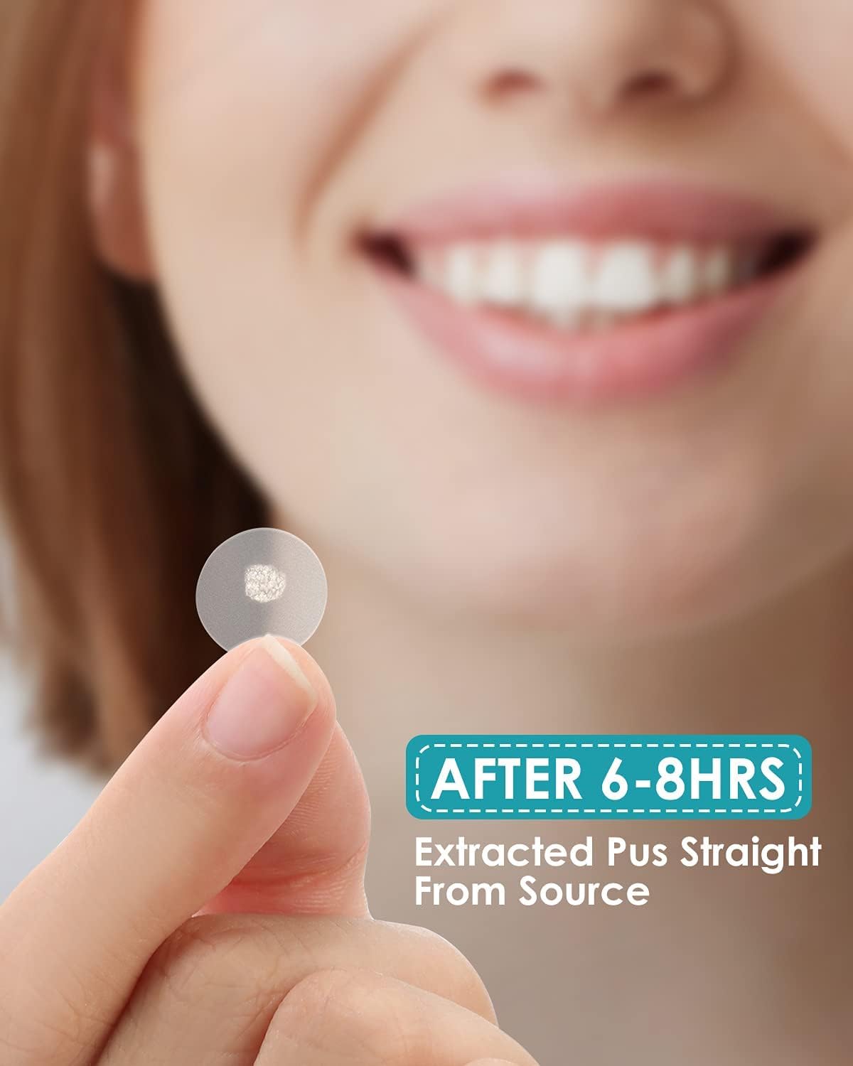 HeroLabs hydrocolloid patches on skin closeup for protection and absorption