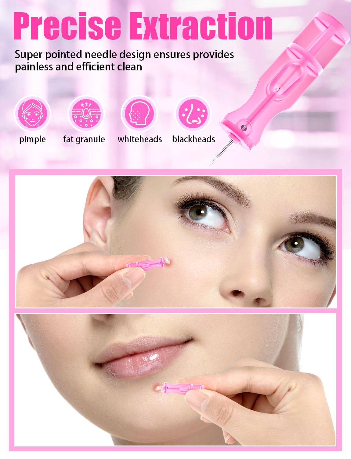HFWTWPY blackhead removal kit designed for precise blemish care at home.