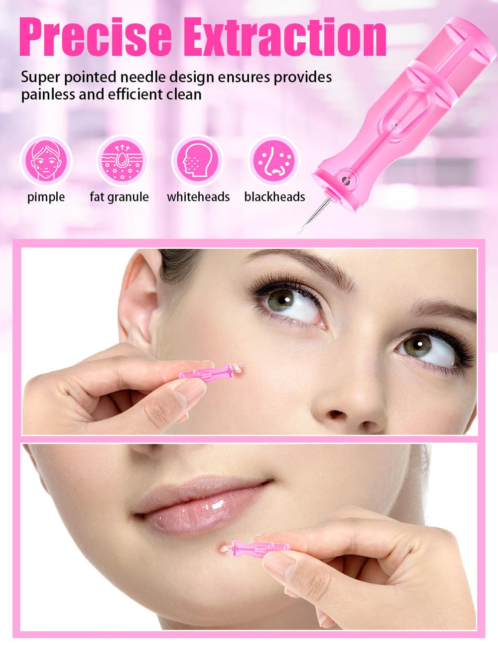 HFWTWPY blackhead removal kit designed for precise blemish care at home.