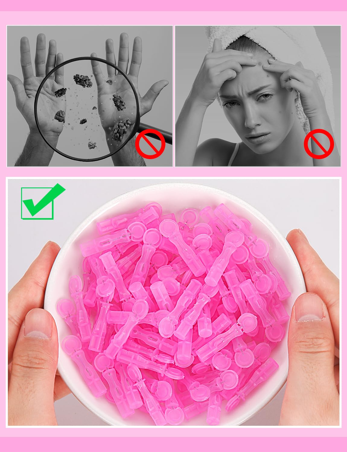 HFWTWPY facial extractions sterile tips support careful blemish removal.