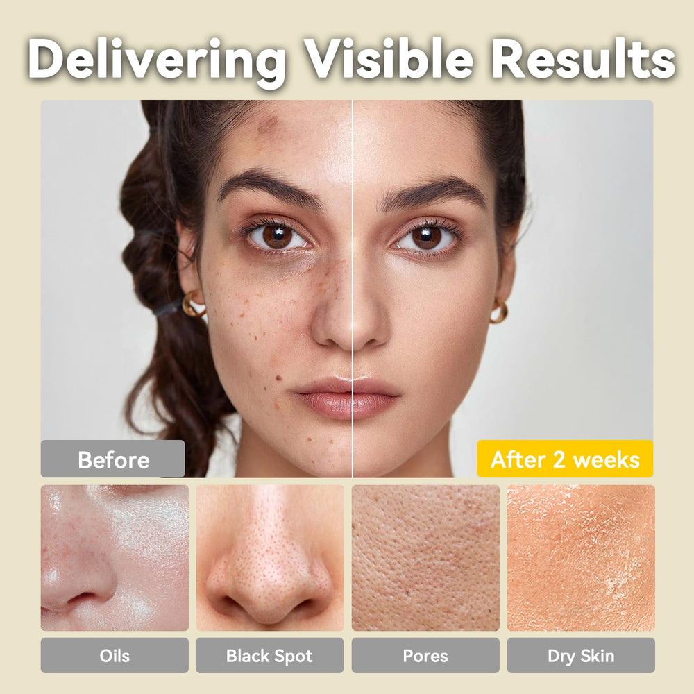 Hicream after-use glow image illustrating refreshed, hydrated skin texture.
