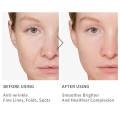 Applying HKH Niacinamide Serum Capsules to skin for even tone and hydration