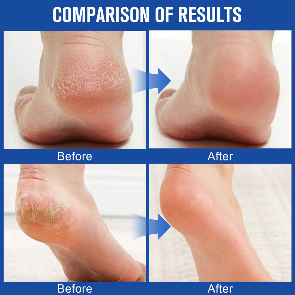 Holyarm lightweight, non-greasy texture for easy absorption.