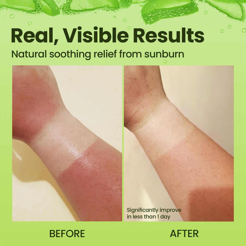 Honeyskin aloe vera gel features pH-balanced formula for gentle use.