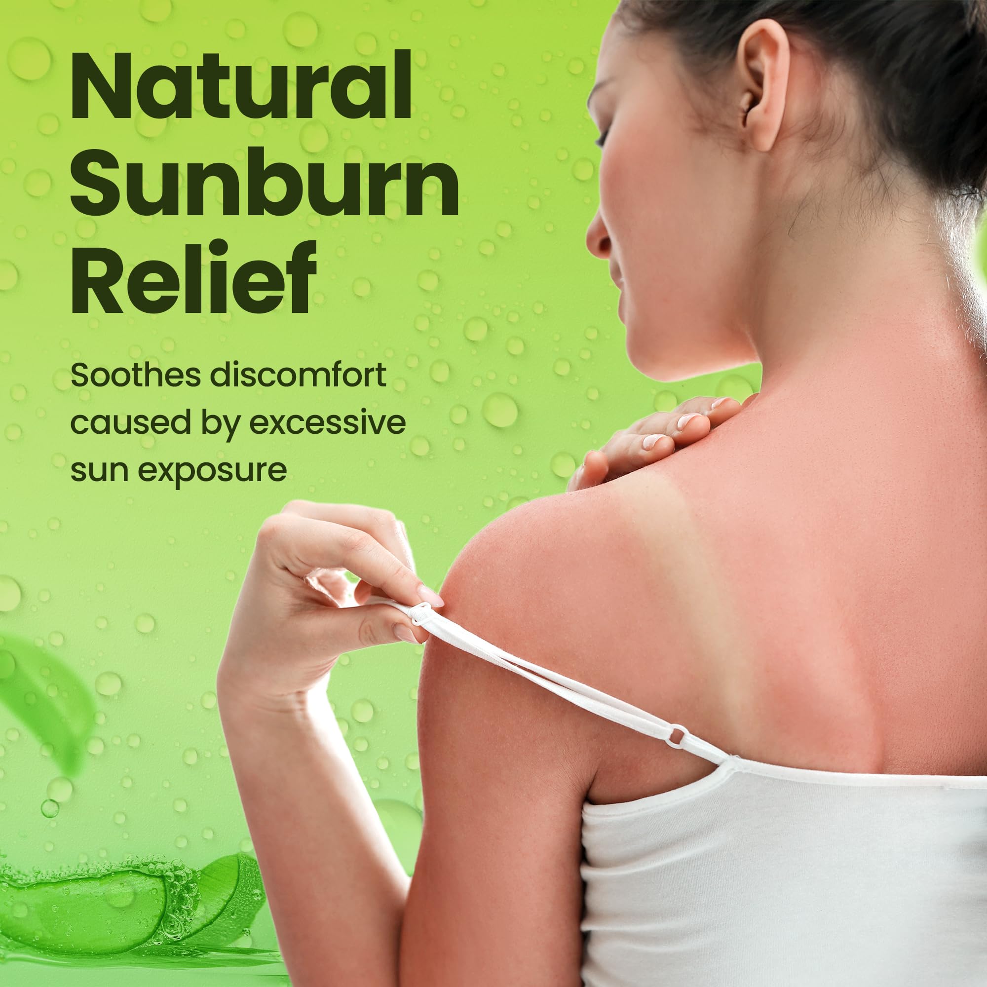 Honeyskin aloe vera gel applied to sunburned skin for soothing relief.