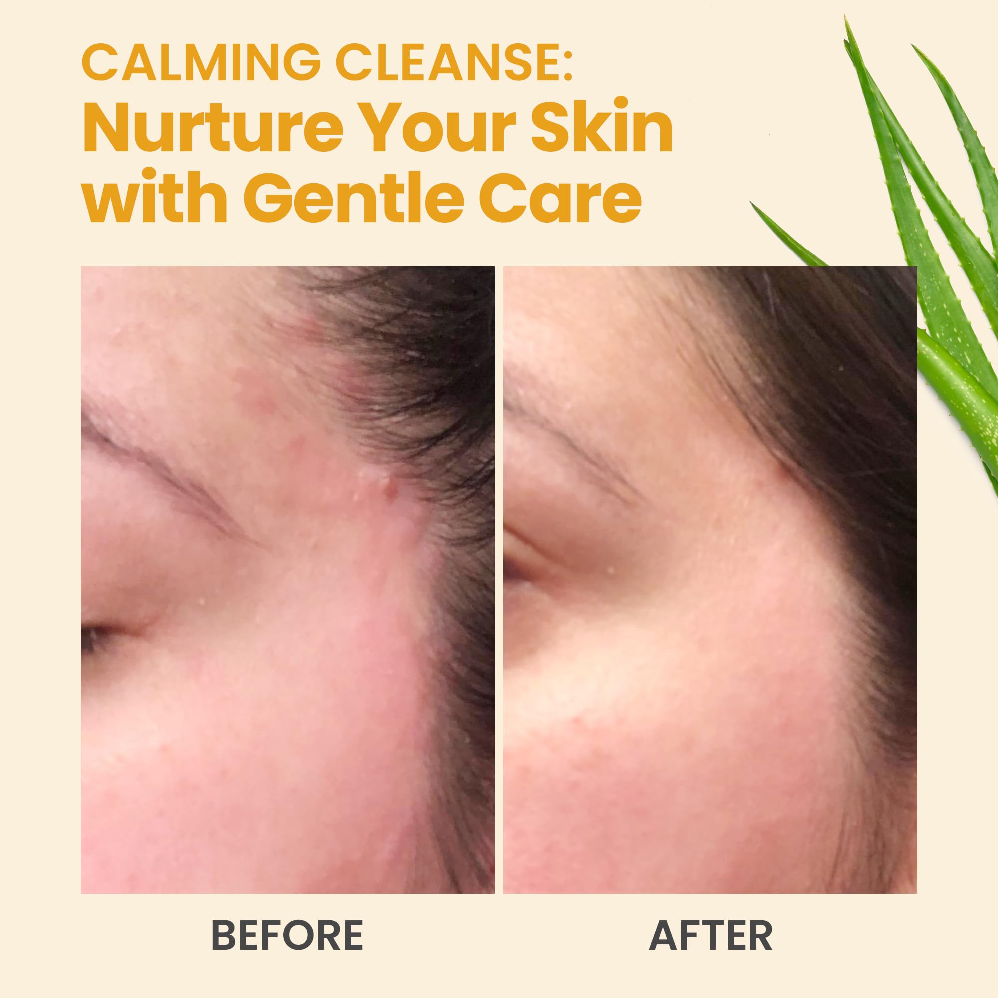 Honeyskin fragrance-free formula ideal for sensitive or reactive skin in daily care.