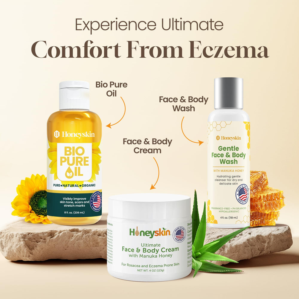 Honeyskin Rosacea and eczema-prone skin use case with mild, protective hydration.