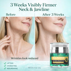 Hrorvei neck and décolleté application demonstrating targeted smoothing